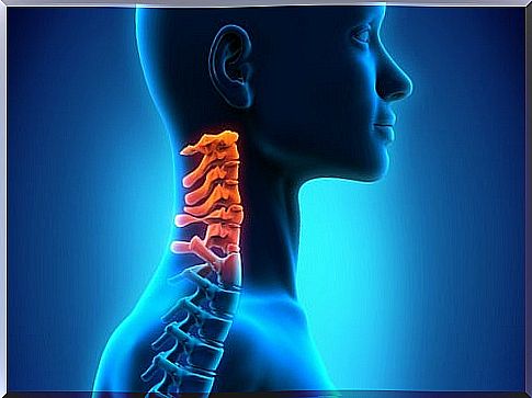 Cervical spondylosis