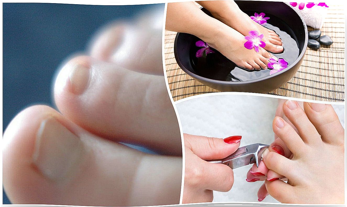 Foot care: cut nails and baths with water.