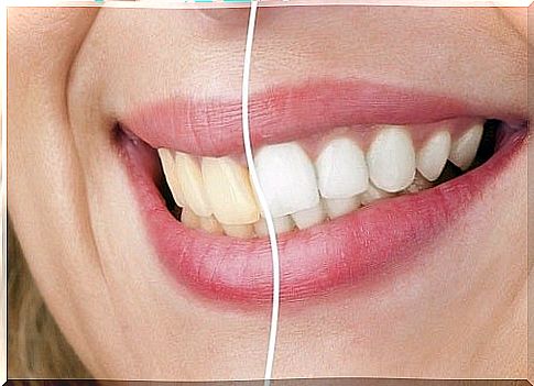 How to whiten your teeth with coconut oil, turmeric and clay