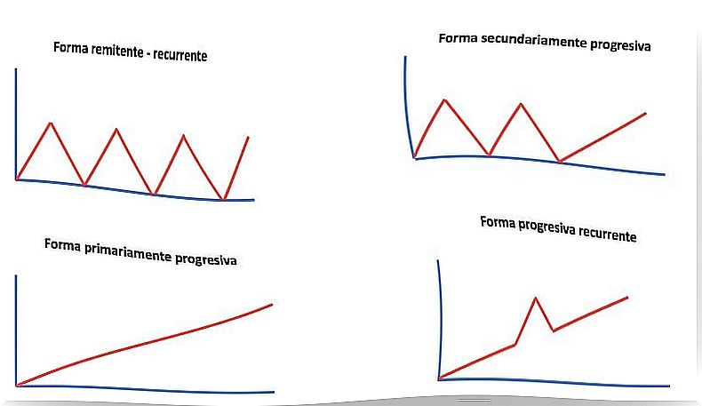 Evolutionary patterns of multiple sclerosis