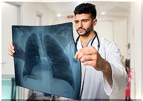 pneumothorax