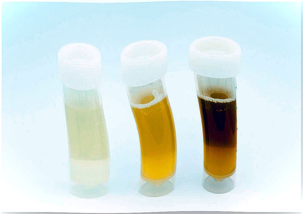 Urine samples.