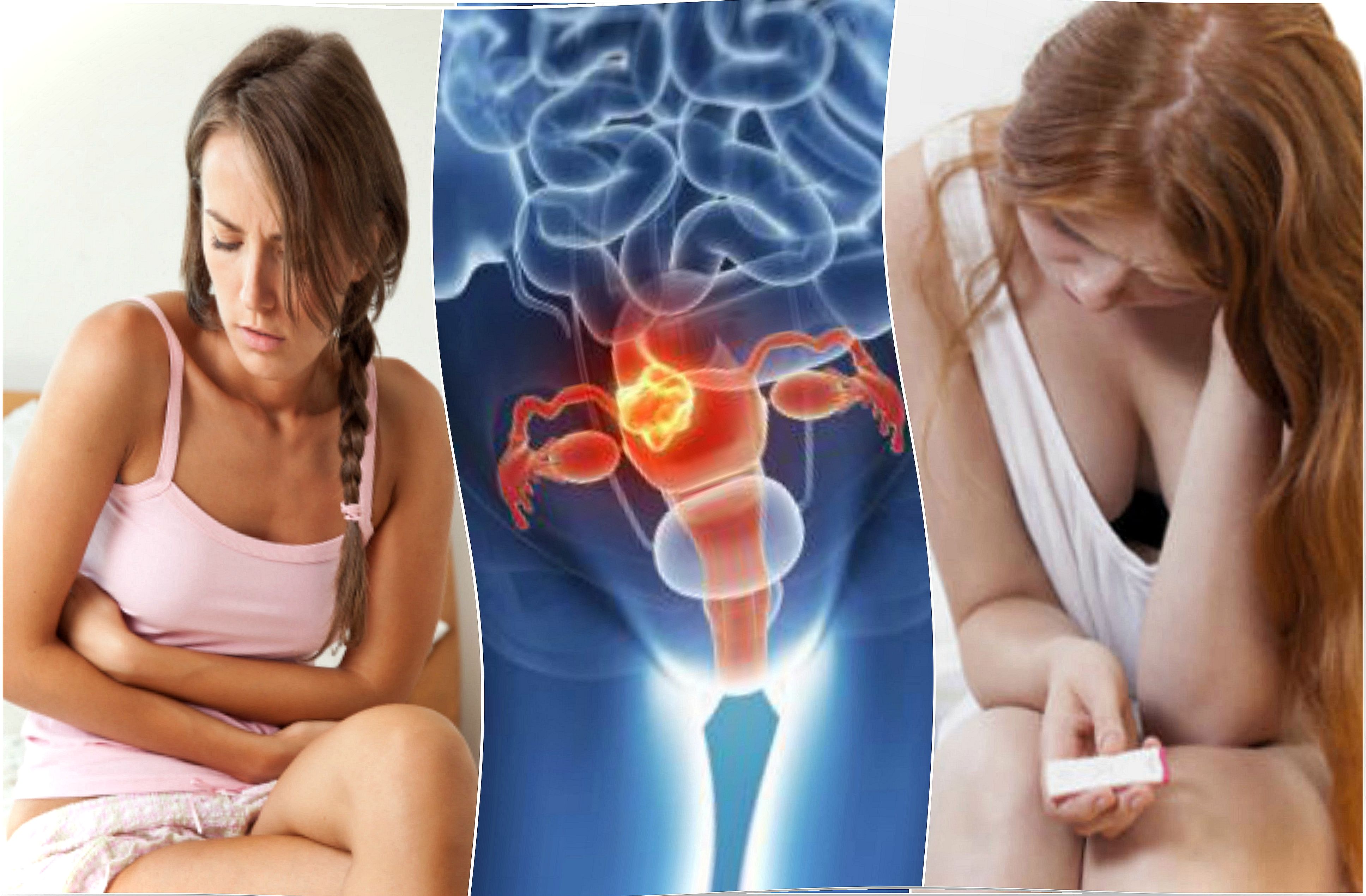 What are uterine fibroids?  5 important facts